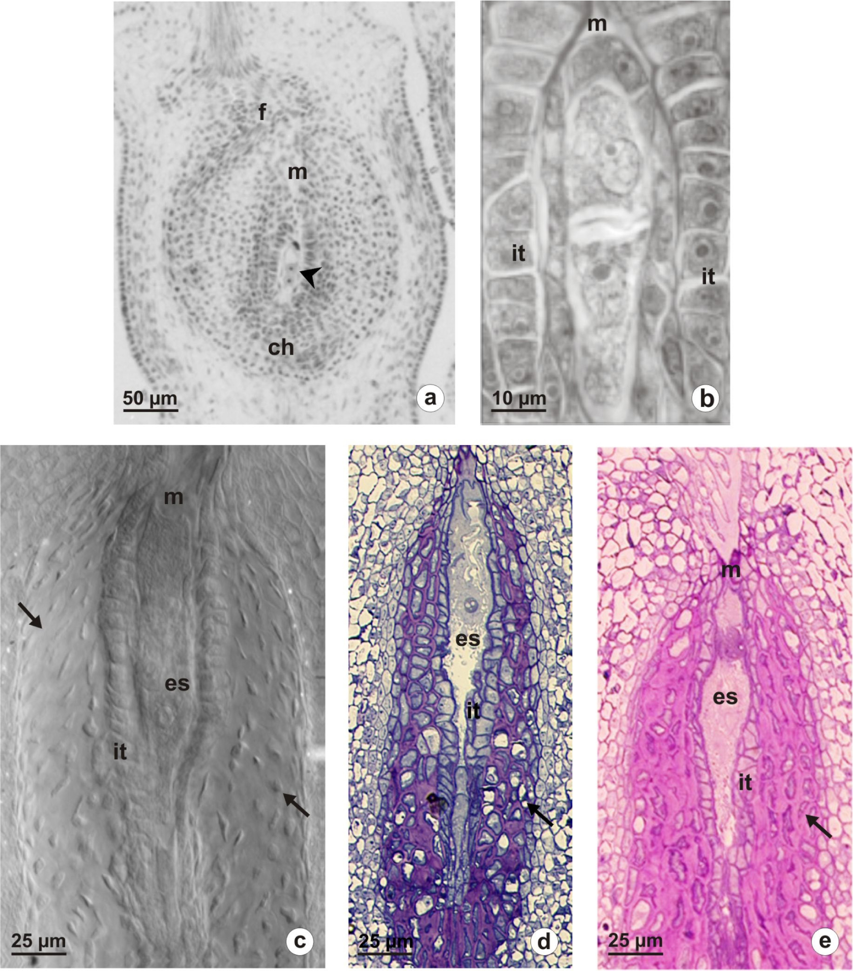 Fig 1. Ovule structure of Taraxacum udum (a, c) and Chondrilla juncea (b, d, e): a – longitudinal section of ovary with anatropous, unitegmic ovule, arrowhead indicates two-nucleate embryo sac; b – diplodyad surrounded by integumentary tapetum; c – ovule at the stage of mature embryo sac, arrows point to a characteristic somatic nutritive zone around the integumentary tapetum, image was obtained from unstained cleared ovule using Nomarski DIC optic; d – semithin longitudinal section of ovule, arrow indicates layers of thick-walled cells; e – ovule after the periodic acid-Schiff treatment, PAS positive reaction is visible in thick walls of the integumentary cells adjacent to the endothelium (arrow). Abbreviations: ch – chalazal pole; es – embryo sac; f – funiculus; it – integumentary tapetum; m – micropylar pole.
