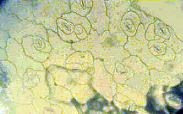 Fig. 1. The cells of epiderma of abaxial side of Sedum telephium L. leaf.