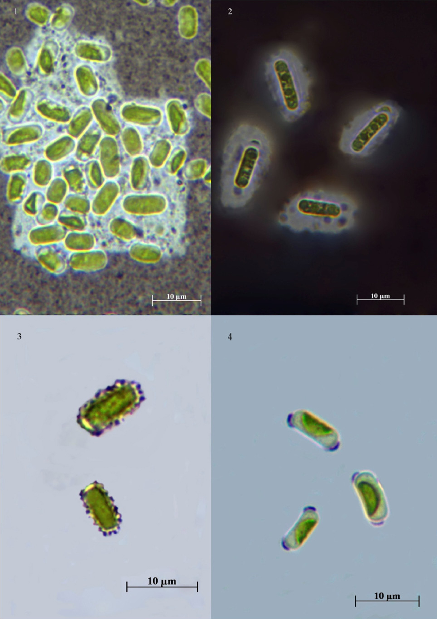 Fig. 1. Typical mucous structures of the members of genus Stichococcus. 1 – colonial mucilage (strain ACKU 868-09); 2 – mucous sheath (strain ACKU 380-04); 3 – mucous grains (strain ACKU 376-04); 4 – mucous caps (strain ACKU 864-09).