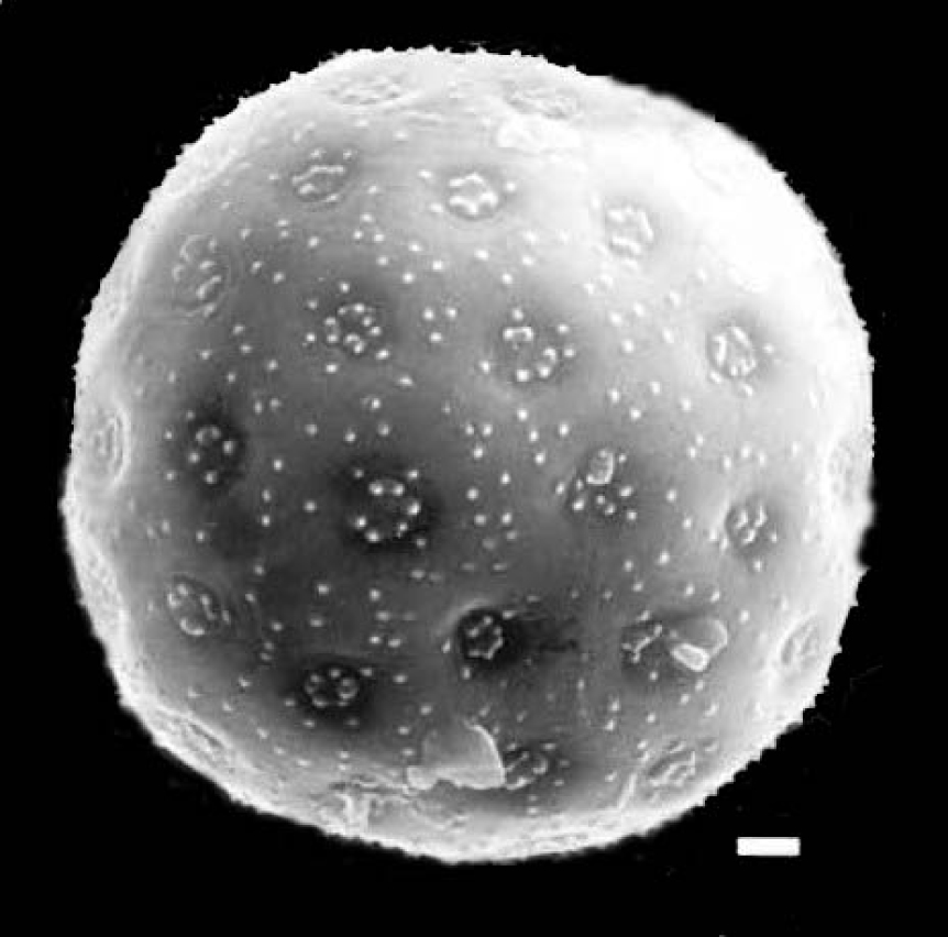 Fig. 1. Pollen grain (SEM) of Suaeda acuminata.